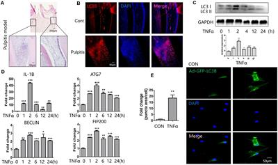 Epigenetic Control of Autophagy Related Genes Transcription in Pulpitis via JMJD3